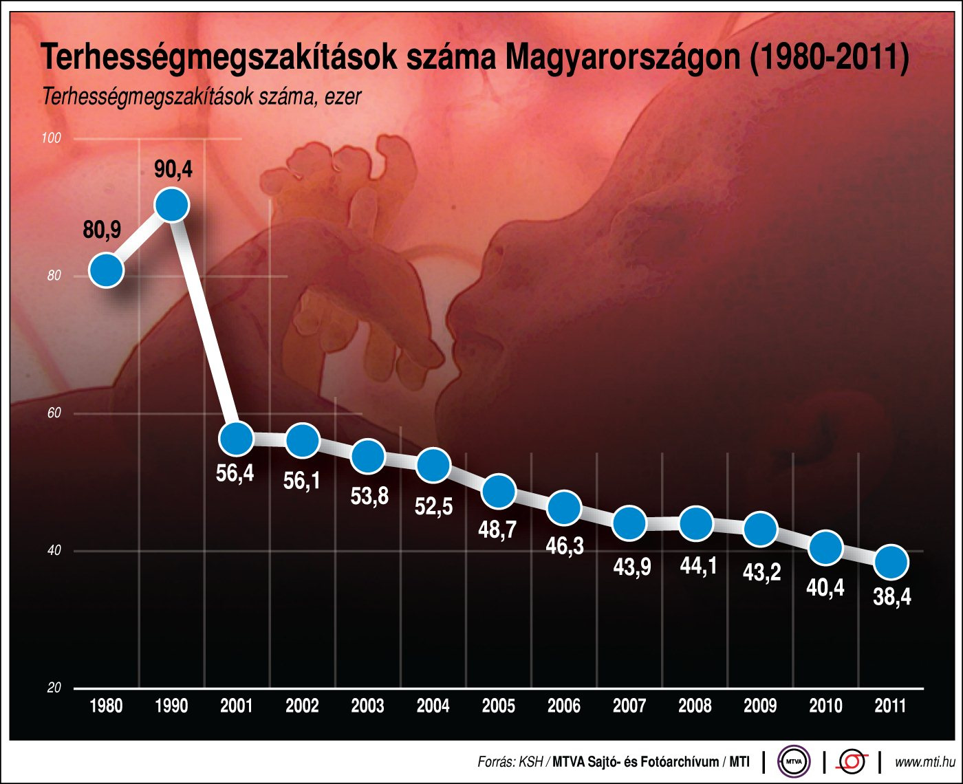 terhességmegszak