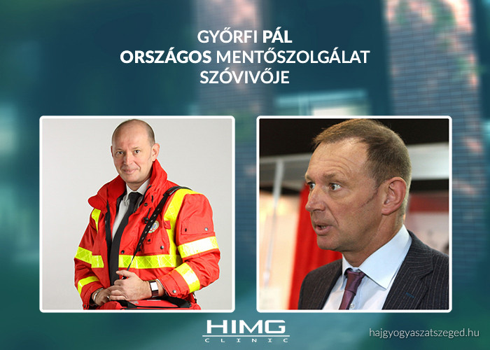 Győrfi Pál - 4000+ hajszál beültetése - HIMG Klinika