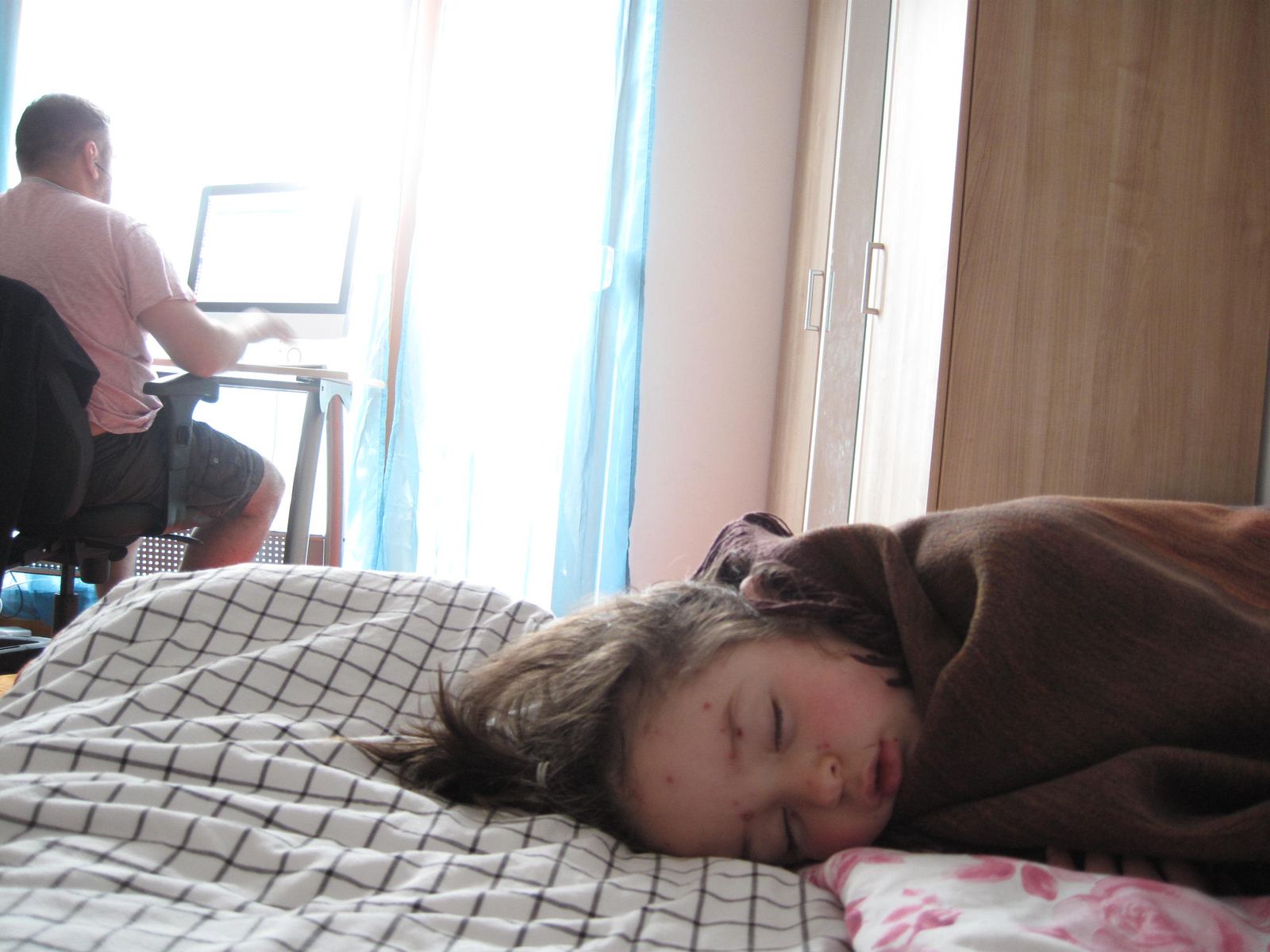 napping during chicken pox