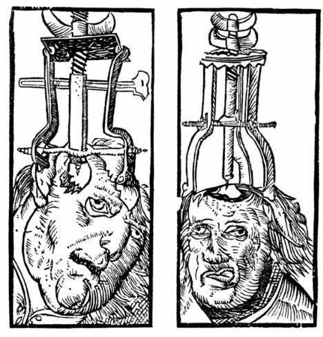 bizarre-cures-trepanning