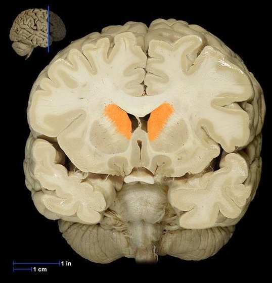 3. Törzsducok -red nucleus amygdala-Mars