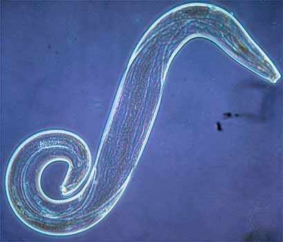 plasmodium falciparum2 (Ho)