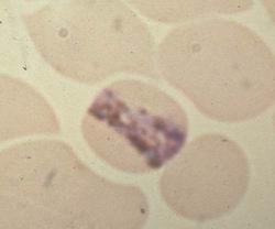 plasmodium malariae2 (Ho)